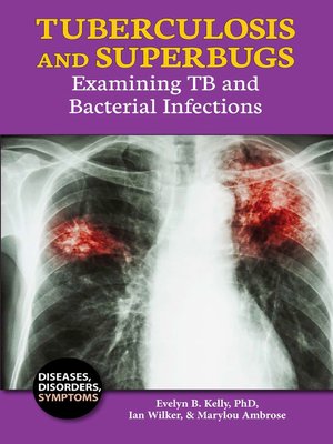 cover image of Tuberculosis and Superbugs